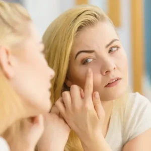 כיצד להסיר מיליה מתחת לעין?