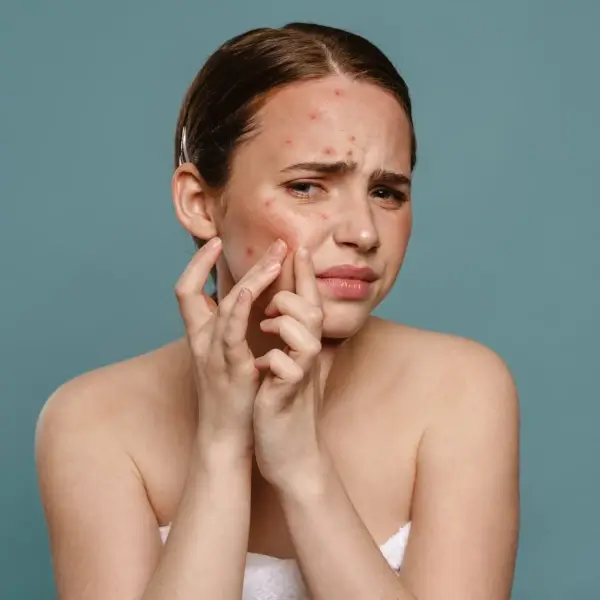 כיצד להשתמש בצללית ירוקה כדי לכסות פצעון אדום?