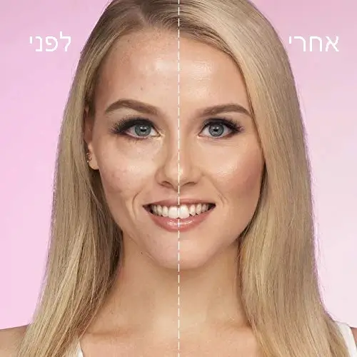 קונסילר טארט לפני ואחרי